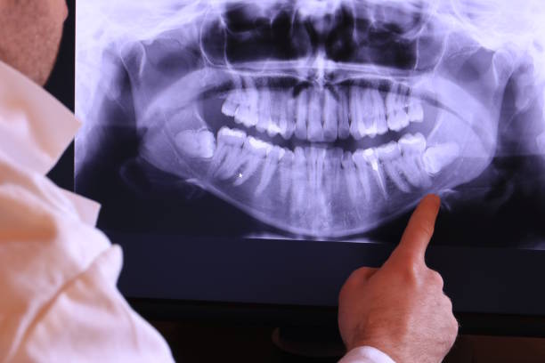 Best Emergency Treatment for Toothache in Ardmore, PA